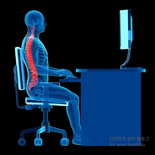 허리디스크 오른쪽 다리저림