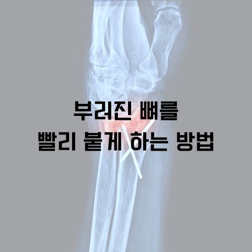 부러진 뼈를 빨리 붙게 하는 방법