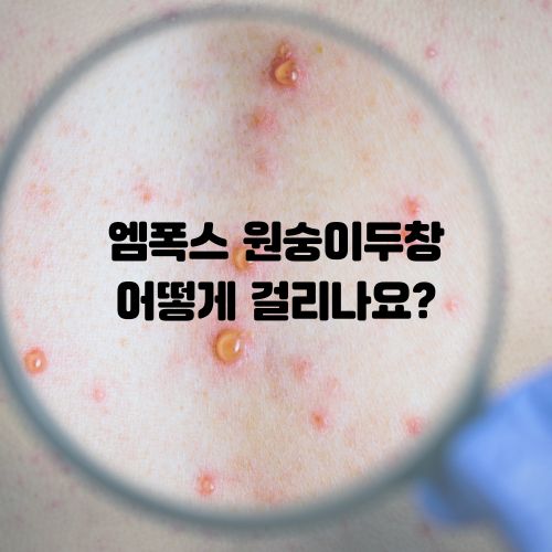원숭이두창 어떻게 걸리나요?