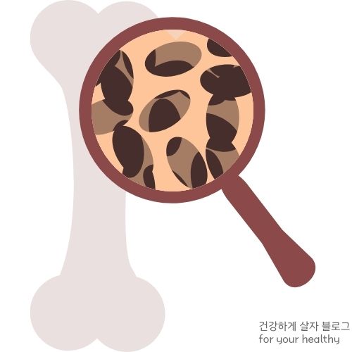 골다공증 주사 언제까지