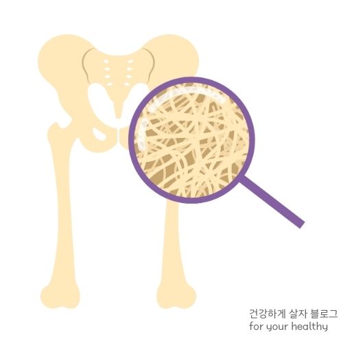 골다공증 주사 언제까지