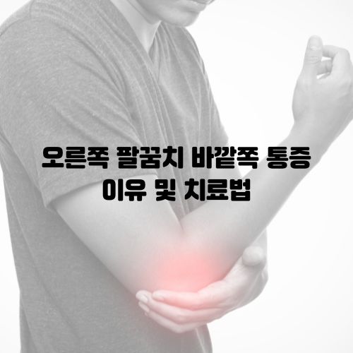오른쪽 팔꿈치 바깥쪽 통증