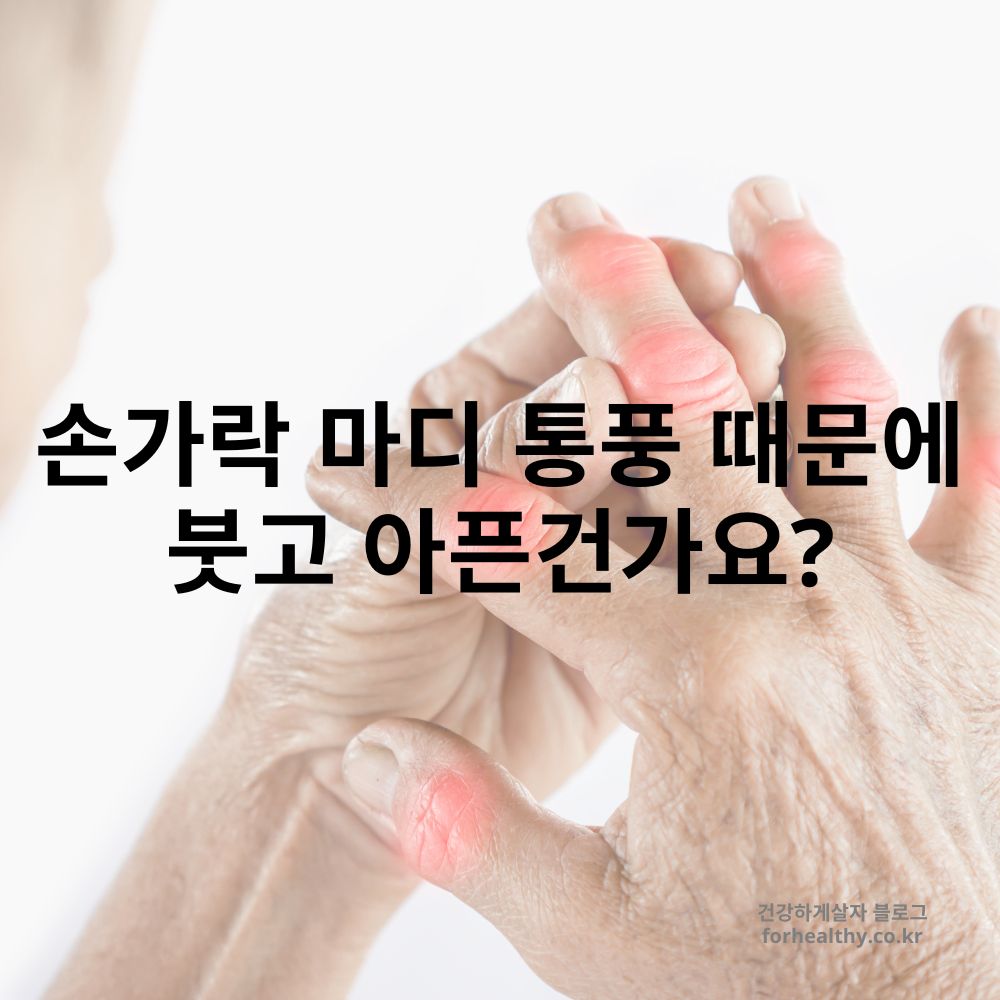 손가락 마디 통풍